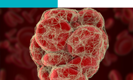 enfermedad tromboembolica